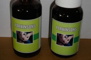 sd 12parkinsons