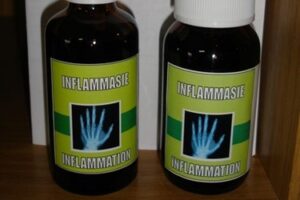 sd 26inflamation