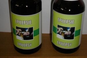 sd 34epilepsy
