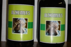 sd 46 alzheimer
